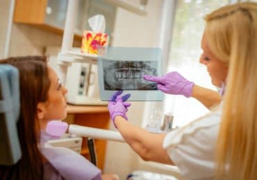 dental implants dentist irvine