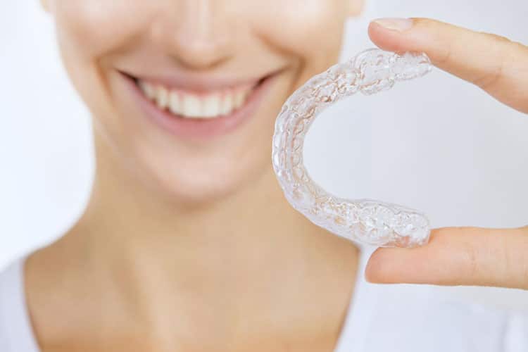 invisalign clear braces irvine orange county ca