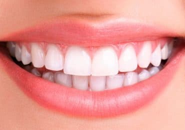 teeth whitening dentist irvine