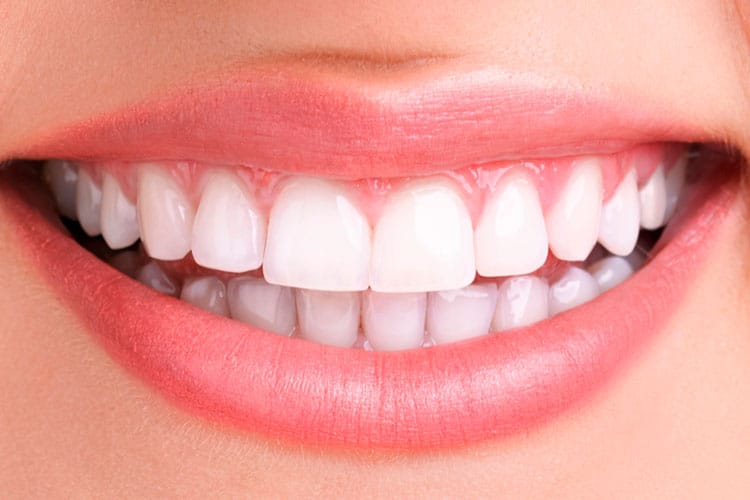 teeth whitening dentist irvine