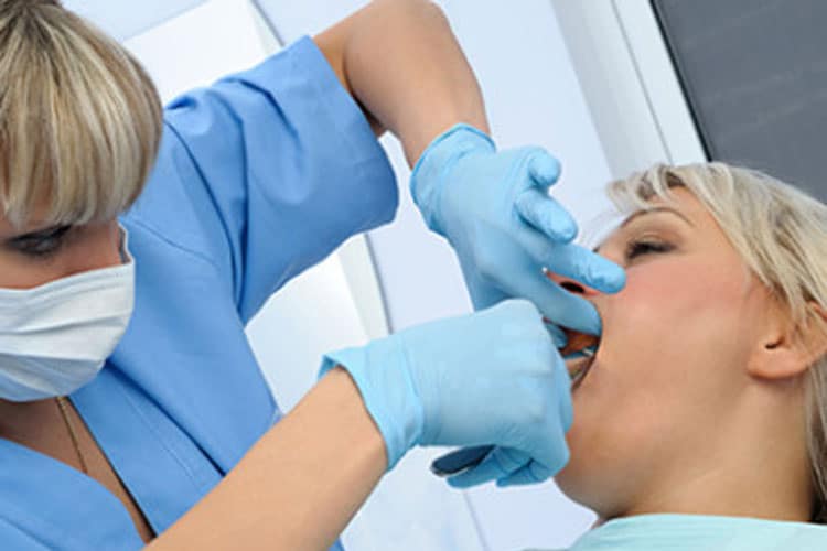 wisdom tooth extraction dentist irvine